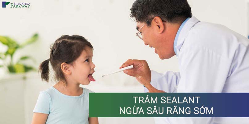 Trám Sealant Ngừa Sâu Răng Sớm