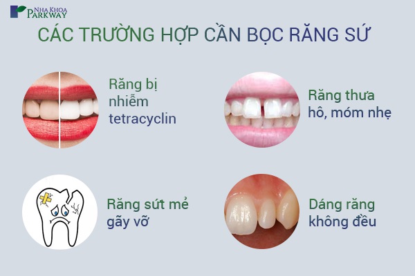 Các trường hợp cần bọc răng sứ