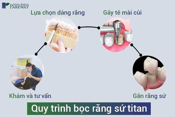 Quy trình bọc răng sứ an toàn