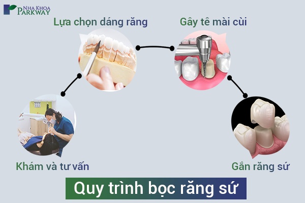 quy trinh boc rang su