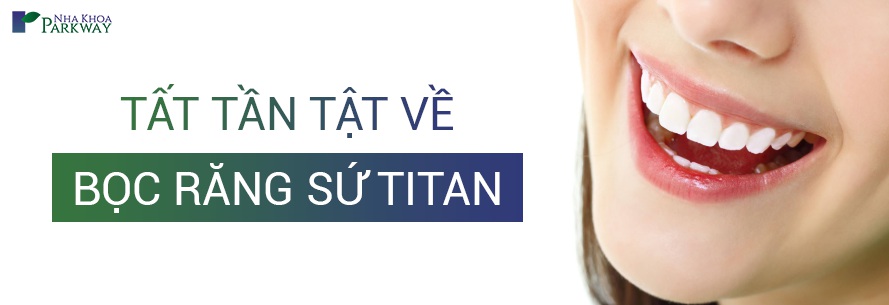 tất tần tật về bọc răng sứ titan