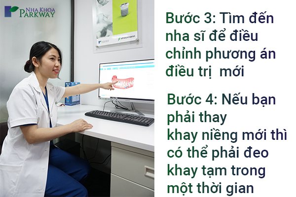 mat khay nieng răng invisalign 2