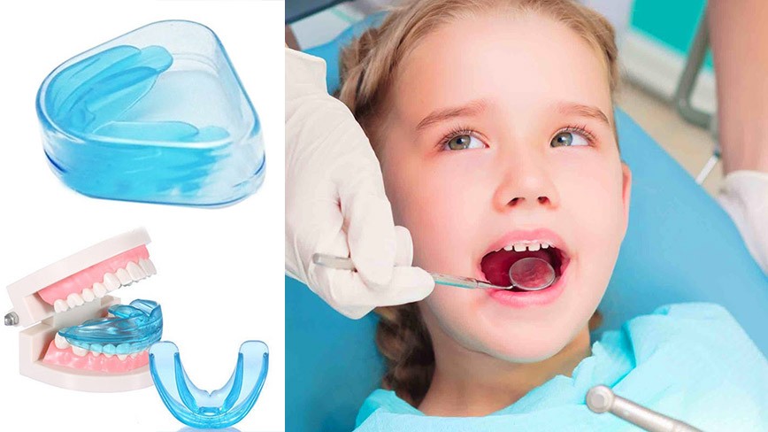 Niềng răng trẻ em với hàm trainer