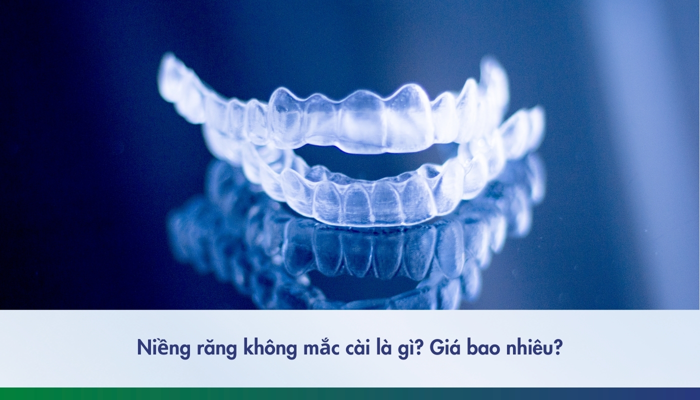 Niềng răng không mắc cài là gì? Có bao nhiêu loại? Chi phí bao nhiêu?