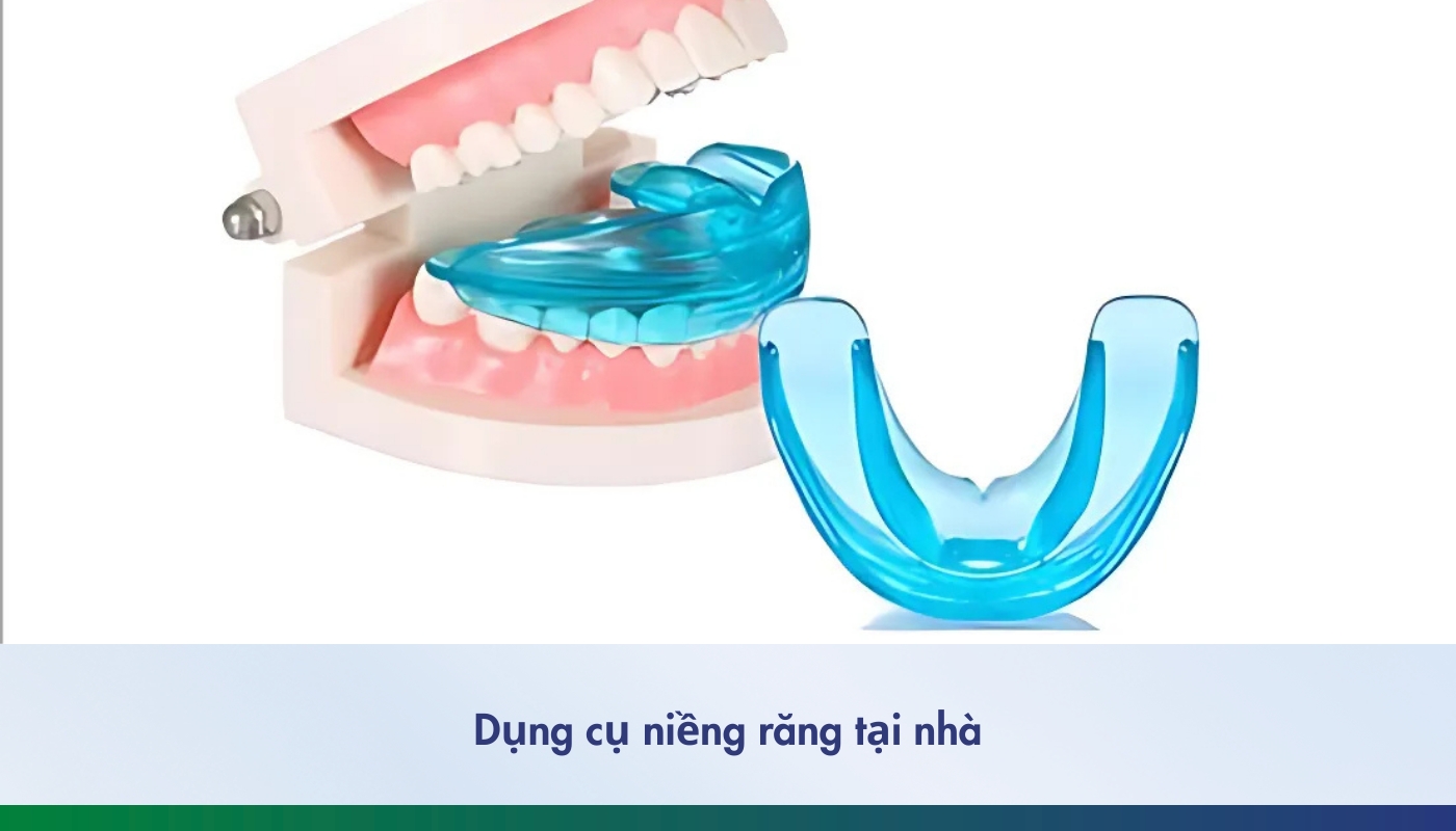 dụng cụ niềng răng tại nhà - 12