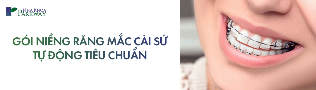 Gói niềng răng mắc cài sứ tiêu chuẩn