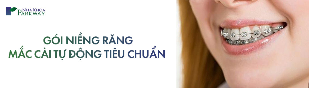 Gói niềng răng mắc cài tự động tiêu chuẩn