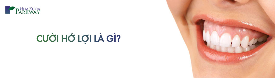 Cười hở lợi là gì? Tướng số người cười hở lợi ra sao?