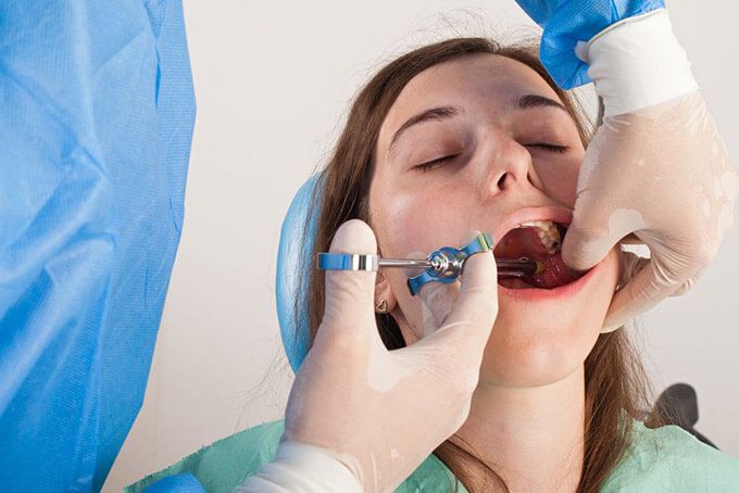 Kỹ thuật gây tê trong điều trị tủy răng - Chia sẻ từ bác sĩ chuyên khoa -  Nha Khoa Parkway