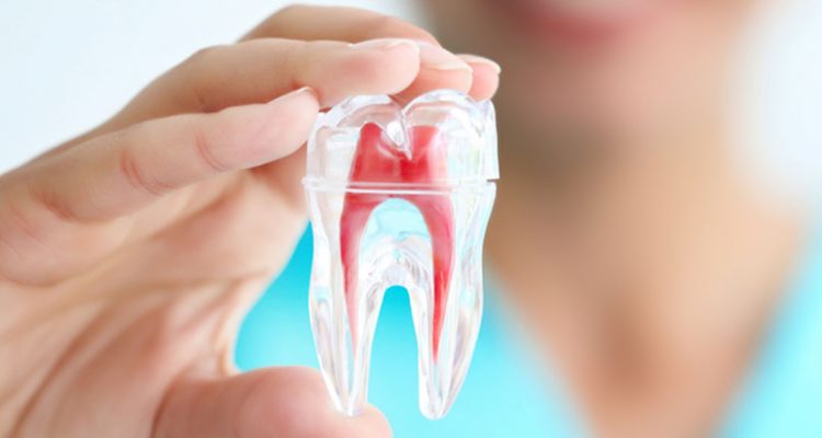 Viêm tủy răng nên ăn gì?