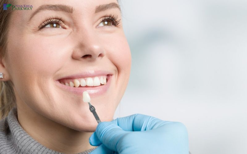 Trồng răng khểnh bằng phương pháp dán sứ siêu mỏng