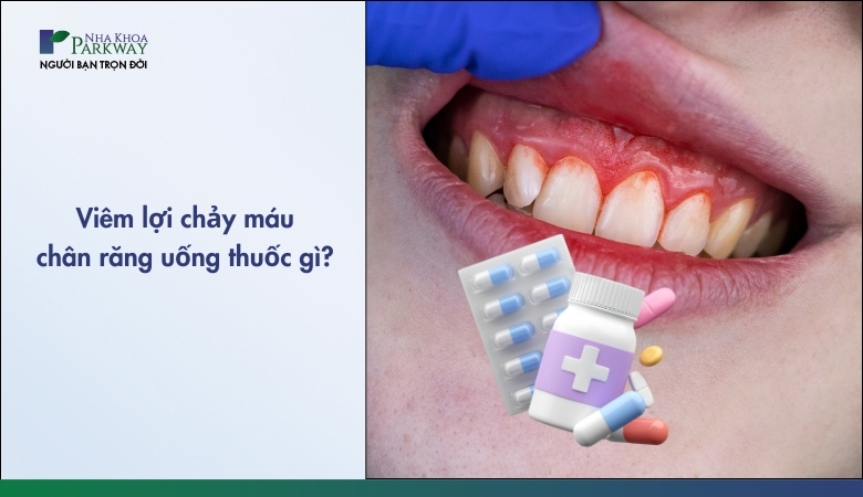 Thuốc chữa viêm lợi