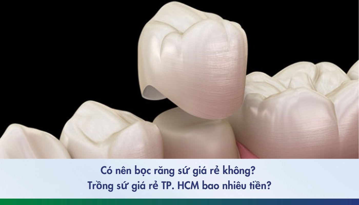 bọc răng sứ giá rẻ 2