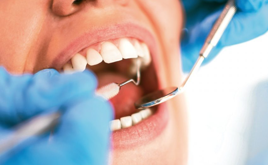Nhổ răng hàm có ảnh hưởng gì không