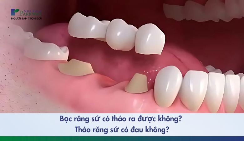 tháo răng sứ có đau không - 3