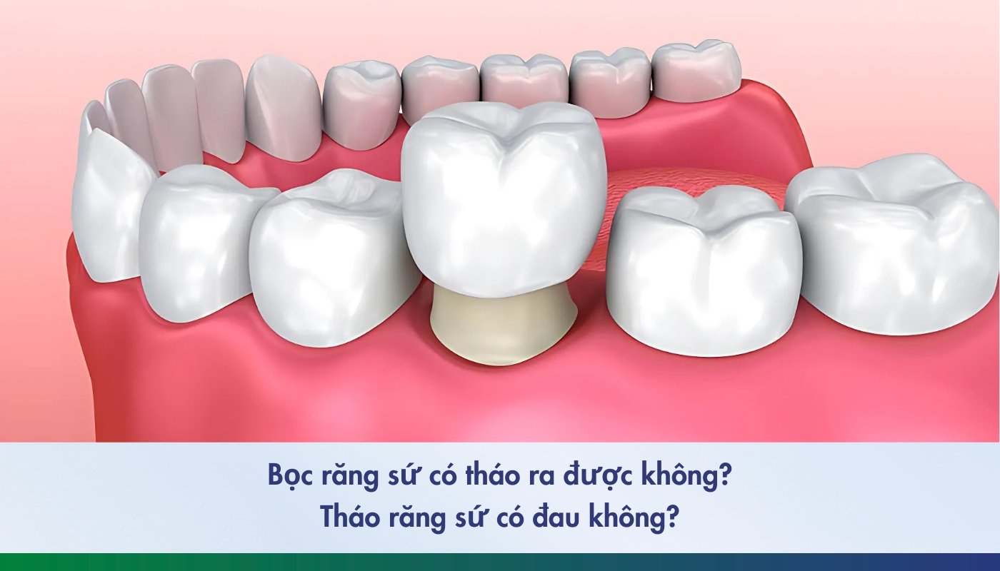 tháo răng sứ có đau không - 4