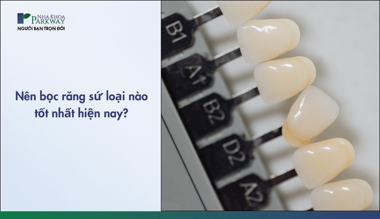 Bọc răng sứ loại nào tốt