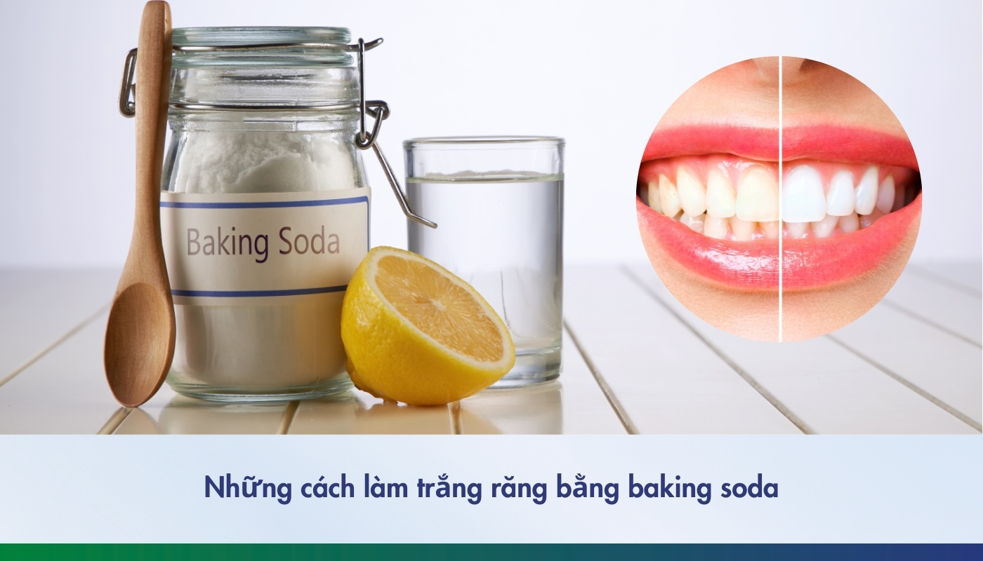 Những cách làm trắng răng bằng baking soda hiệu quả tại nhà