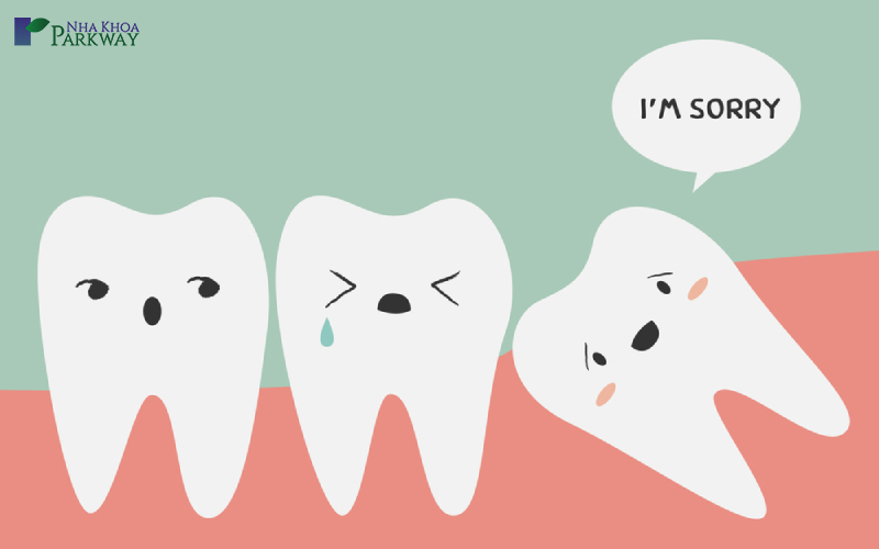 chăm sóc răng khôn sau khi nhổ phải làm gì