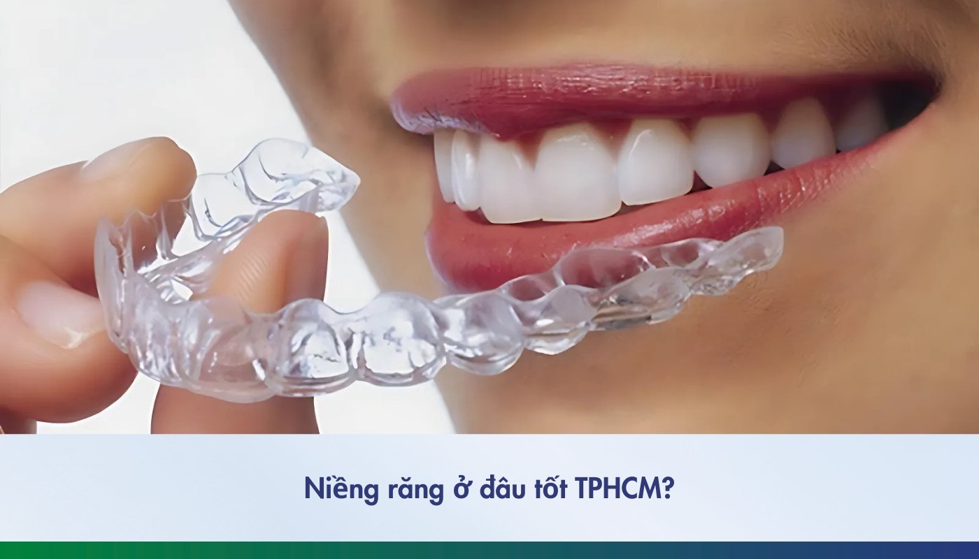 Niềng răng ở đâu tốt TPHCM và những tiêu chí lựa chọn