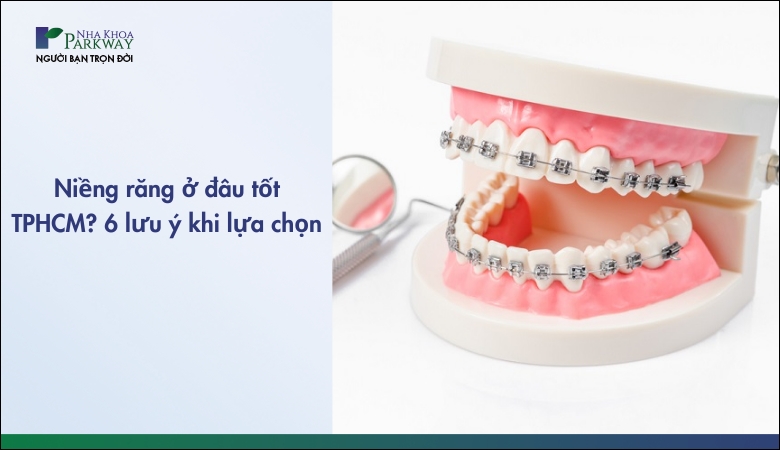 Niềng răng ở đâu tốt TPHCM