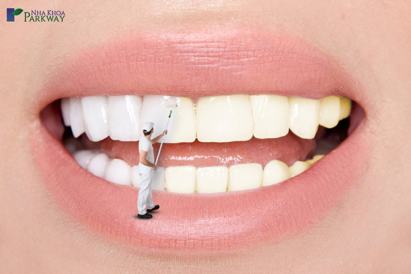 trồng răng implant mất bao nhiêu thời gian