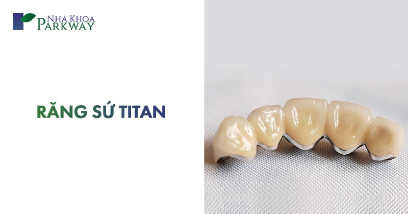 bọc răng sứ titan có mấy loại