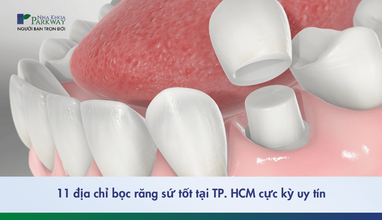 địa chỉ bọc răng sứ tốt tại tphcm