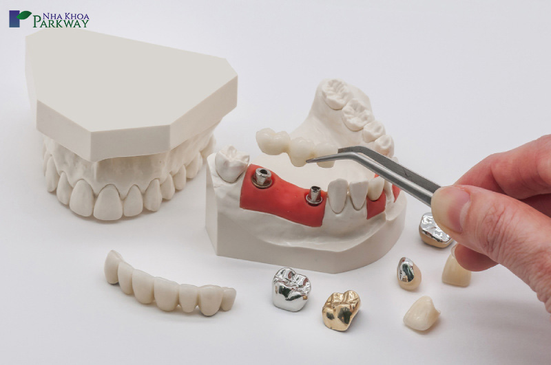 dán răng toàn sứ zirconia là gì