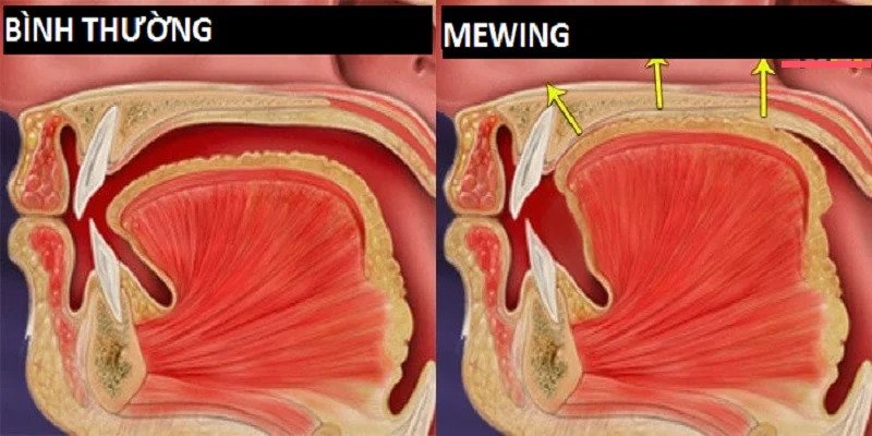 hướng dẫn cách tập mewing cho cơ mặt