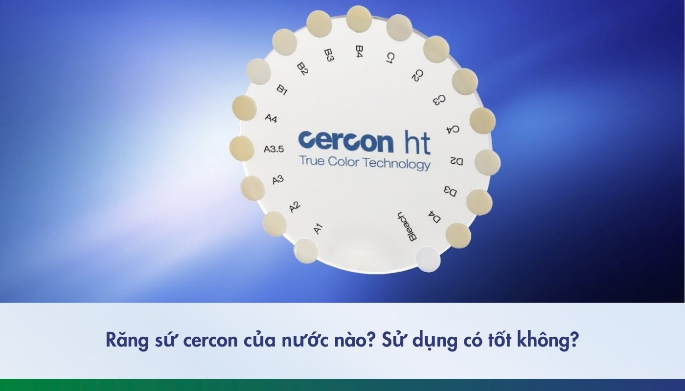 Răng sứ Cercon: Giải pháp tối ưu cho nụ cười hoàn hảo