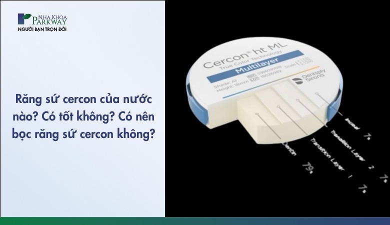Răng sứ cercon có tốt không