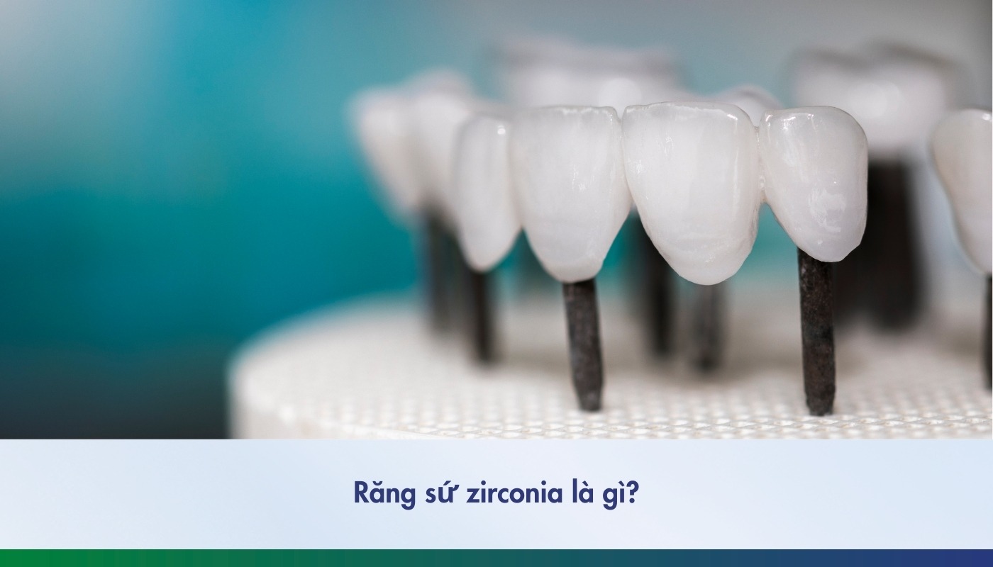 Răng sứ Zirconia: Giải pháp phục hình răng toàn diện