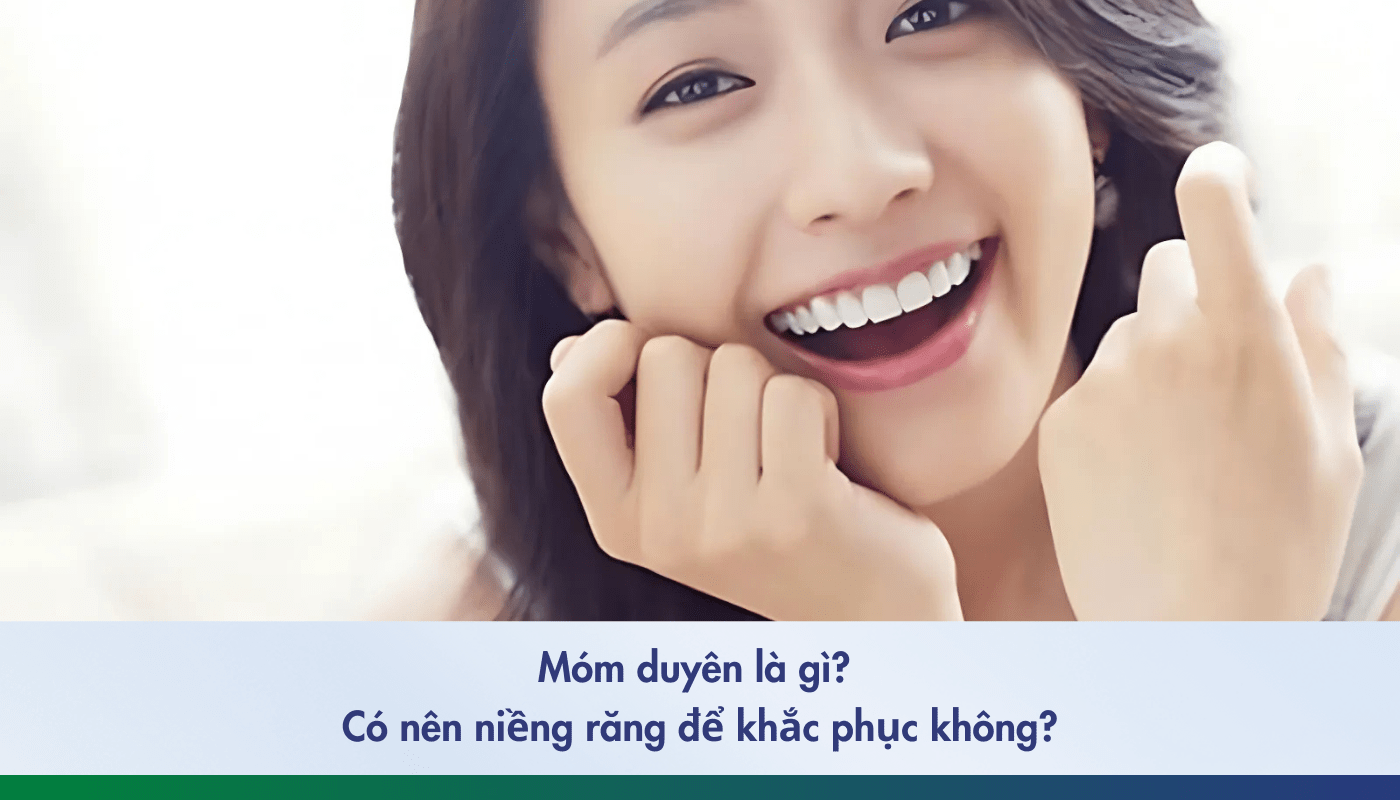 móm duyên là gì