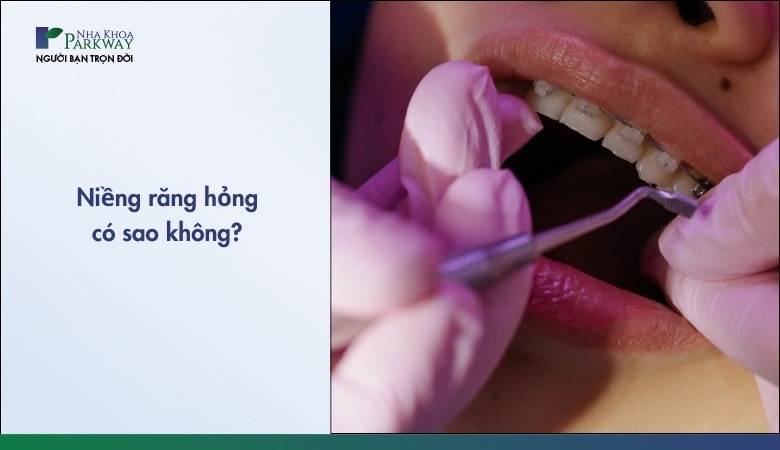 Nguyên nhân niềng răng xong vẫn xấu