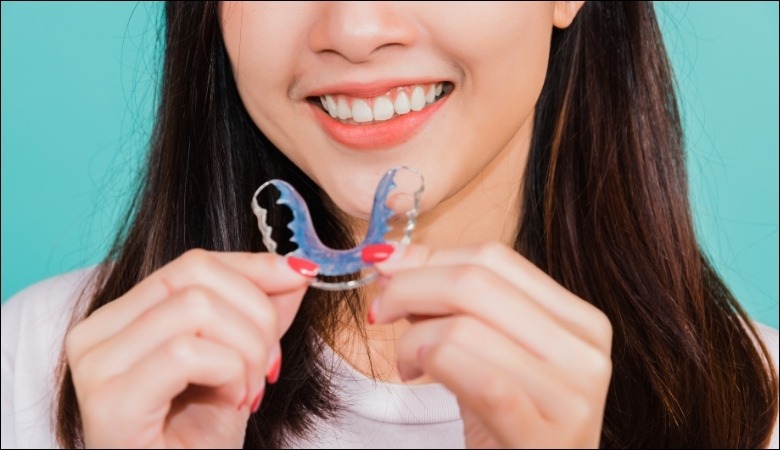 Niềng răng xong vẫn xấu do không đeo hàm duy trì sau tháo niềng