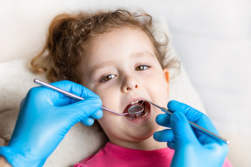 dấu hiệu trẻ em bị sâu răng
