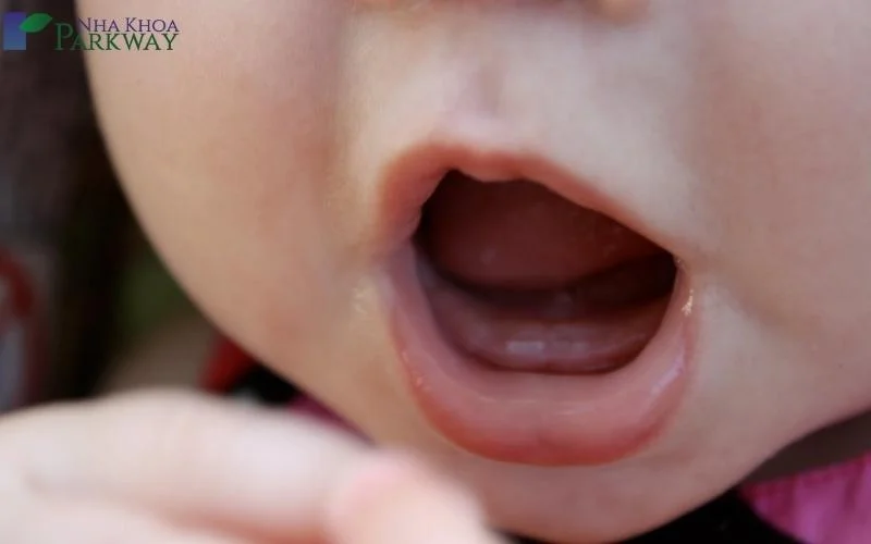 Trẻ mọc răng không đúng thứ tự do rất nhiều nguyên nhân