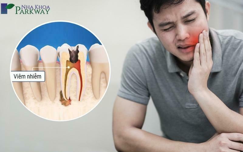 Những nguyên nhân chính gây ra việc đau nhức răng