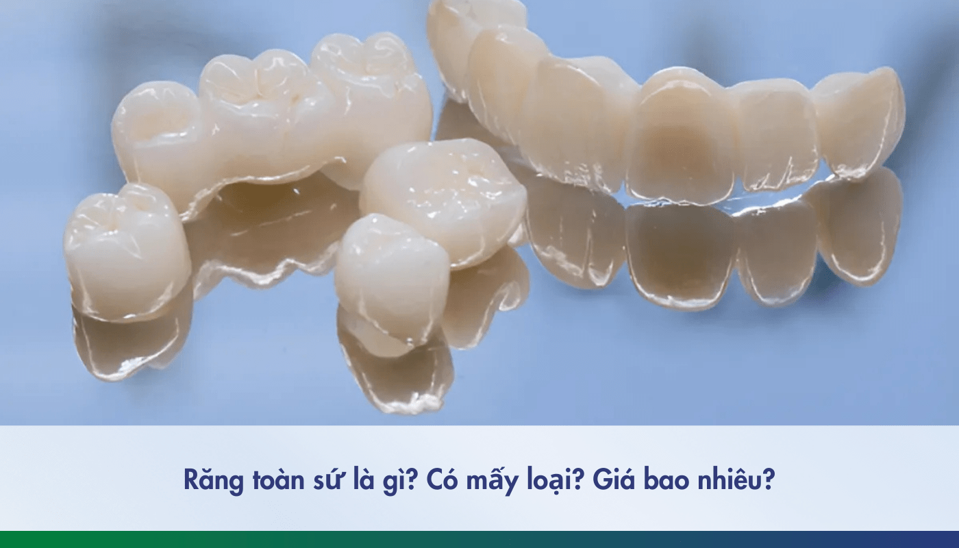 răng sứ toàn sứ