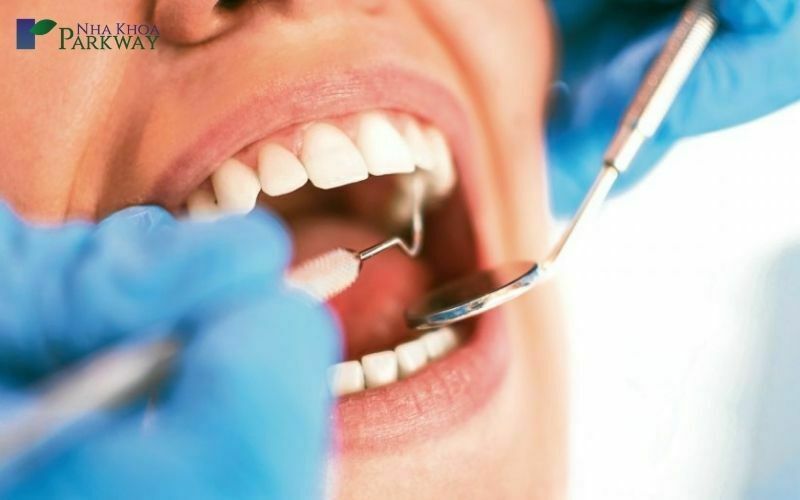 Điều trị sưng nướu răng trong cùng hàm dưới và hàm trên như thế nào?
