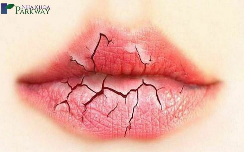  19 nguyên nhân gây đắng miệng và cách khắc phục tốt nhất