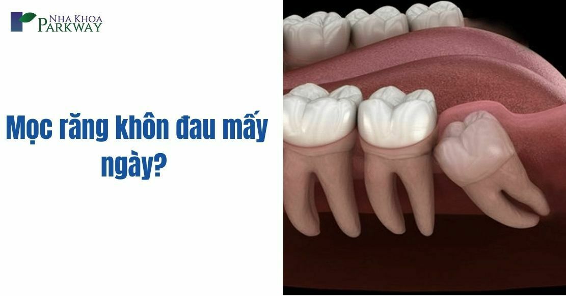 Mọc răng khôn đau mấy ngày? Làm thế nào để giảm đau?