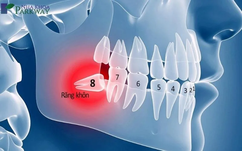 Nếu gặp phải răng khôn mọc ngầm, bạn cần nhờ đến sự trợ giúp của nha sĩ 