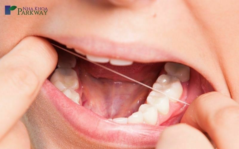 Phương pháp phòng ngừa sưng nướu răng trong cùng hàm trên và dưới