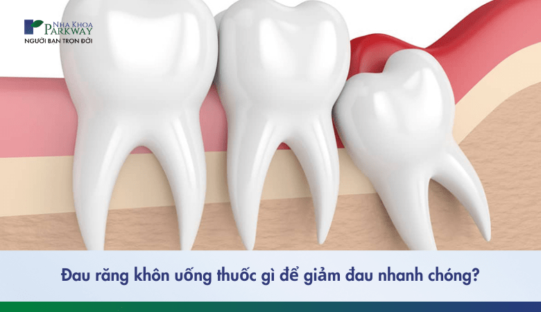 Đau răng khôn uống thuốc gì giảm đau nhanh