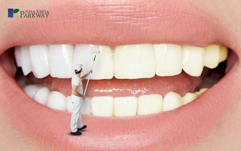 Phương pháp tảy trắng răng có hại hay không