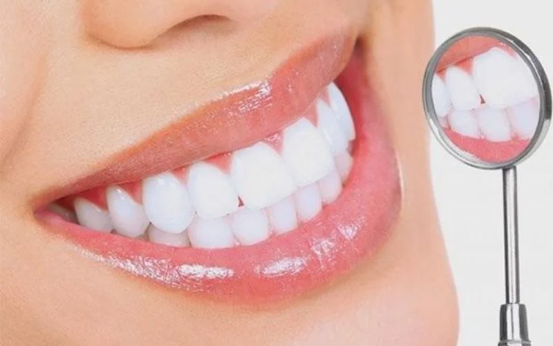 Bọc răng sứ có được bảo hiểm không?