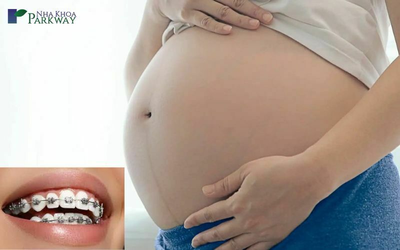 Khi đang niềng răng mang thai phải làm sao?