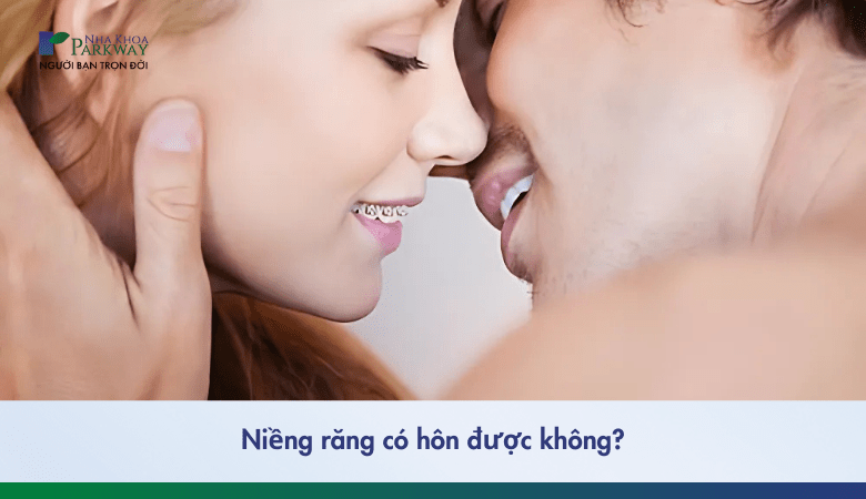 niềng răng có hôn được không và những mẹo nhỏ